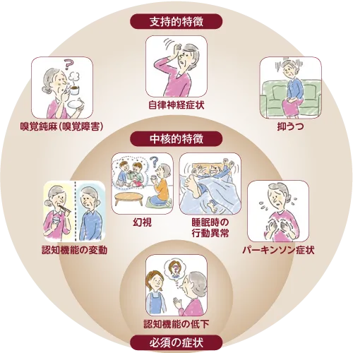 レビー小体型認知症の症状