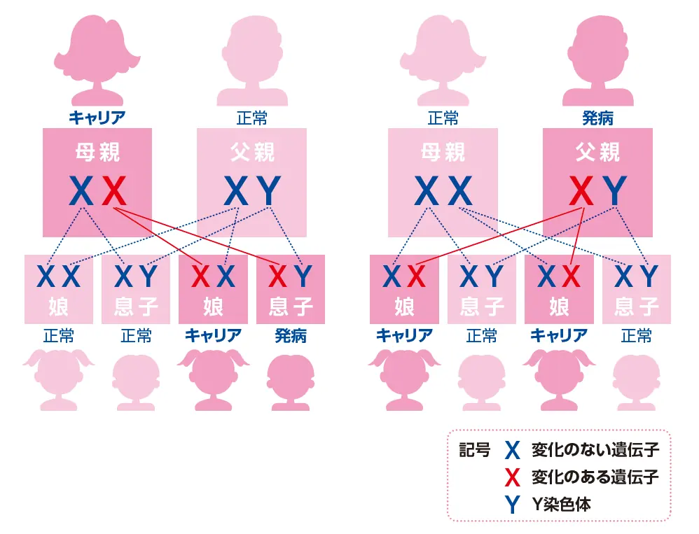 ファブリー病の遺伝