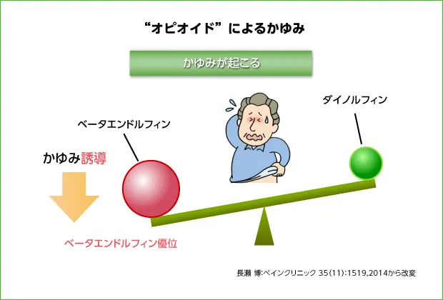 オピオイドによるかゆみ