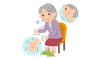 パーキンソン病の四大症状:安静時振戦