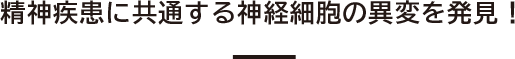 精神疾患に共通する神経細胞の異変を発見!